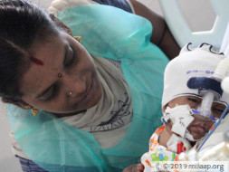 Support 3-months old Arun to fight cardiac problem