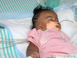 9-months old baby of Suma needs your help for his treatment