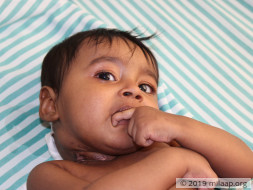 8-months old baby Lihan needs your help for the treatment