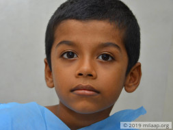 Support 6 years old Sabareesh to fight disease
