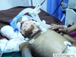 Single Mother Struggles To Save Son From Disease That Paralyzed Him