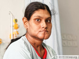 Paramita needs your support to undergo her treatment