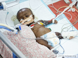 Despite Being On Ventilator, This Baby Boy Will Die Without Help Now