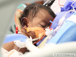 Despite Working Hard, Daily Wager Can't Save Baby From Heart Disease