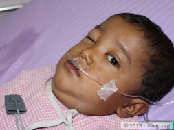 3-Year-Old Will Suffocate To Death If His Chest Tumor Is Not Removed