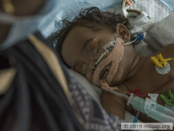 Daily Wager's Only Daughter Struggles To Breathe, Needs Urgent Help