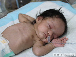 Mother Struggles To Save Baby Girl From A Rare And Deadly Disease