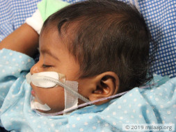 6-Month-Old Baby's Liver And Lungs Are Severely Infected, Needs Help