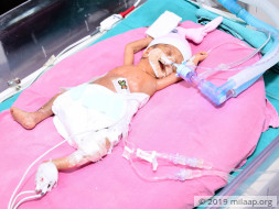 Baby of Santosh needs your help to fight disease