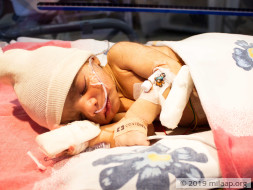 Only An Urgent Surgery Can Save This 11-Day-Old Baby Boy's Life
