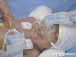 Helpless Mother Struggles To Save Her Newborn Twins