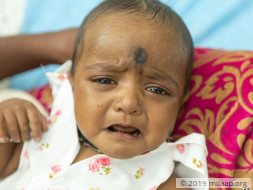 Baby With Painfully Swollen Stomach Needs Urgent Liver Transplant