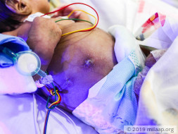 Baby of Lucky needs your help to fight disease