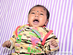 Poor Sweeper Struggles To Save 4-Month-Old From Severe Heart Disease