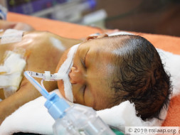 12-Day-Old Baby Girl Who Struggles For Every Breath Needs Urgent Help