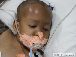 Partially Blind 5-Year-Old Needs ICU Stay To Recover From Infections