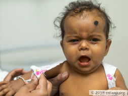 Baby Amrutha Das needs your help to undergo Liver Transplant
