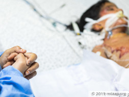 7-Year-Old Is Severely Burnt After Falling Into Boiling Water