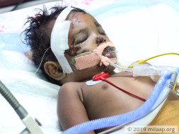 Nehasri needs your help to undergo treatment