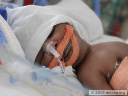 Help Baby of valli to fight disease