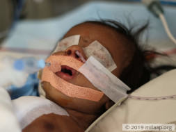 Farmer's 2-Month-Old Can Fight Heart Disease With Your Help