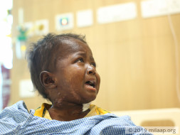 2-year-old May Die Of Cancer Because He Does Not Have An Aadhar Card