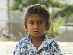 Boy Living On ORS Due To Failing Liver Needs Your Help To Survive