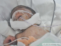Baby of Dakshayini needs your help to survive