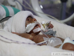 Baby of Swaroopa needs your help to fight disease