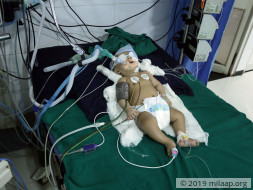 You Can Save This 4-Month-Old Baby Boy From Brain Damage