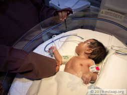 24 Hours To Keep This Newborn Baby's Heart Beating