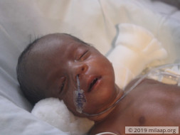 Twin Babies of Jeyakumari Premature needs your help to survive