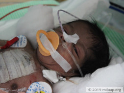 Baby of Lavanya needs your help to survive