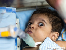 Father Lost Job While Trying To Save Baby, Needs Help To Treat Her