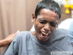 Dasari Uma Manikanta Swamy needs your help to undergo Liver transplant