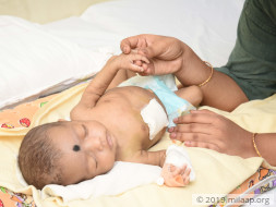 Bhargavi needs your help to undegro her treatment