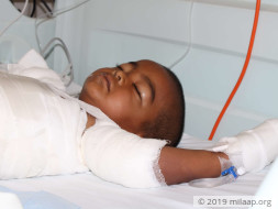Boy Who Accidentally Fell Into A Vessel Of Boiling Milk Needs Help