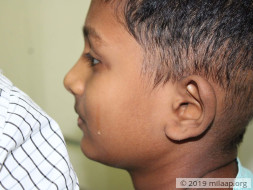 Santhosh needs your help!