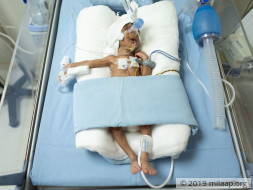 Help Jyothi's Premature Twins