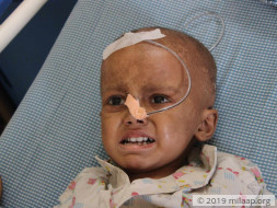 Akshar Patolla needs your help to undergo his treatment