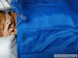 Baby of Parvathi needs your help to survive
