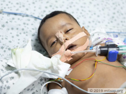 Jasvin Nagineni is in the ICU and need your help to survive