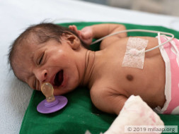 Baby of Jyoti needs your help to survive