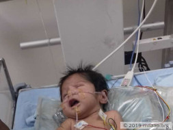Baby of Sweta is in the ICU and needs your help to survive
