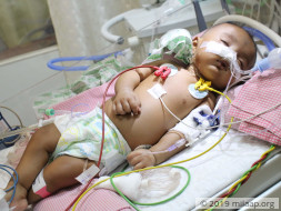 Baby Sneha needs your help to undergo her treatment