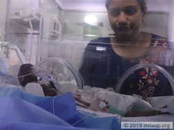 Baby of Sandhyarani needs your help to survive