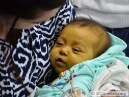 Baby Rukhsorabonu needs your help urgently
