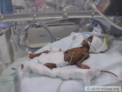 Help Baby of Pushpalatha Recover