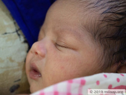 Baby of Pragya needs your help to survive