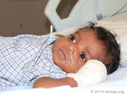 Help Baby of Shravanthy Fight Immuno Deficiency